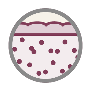 Petechiae, Purpura, Bruising