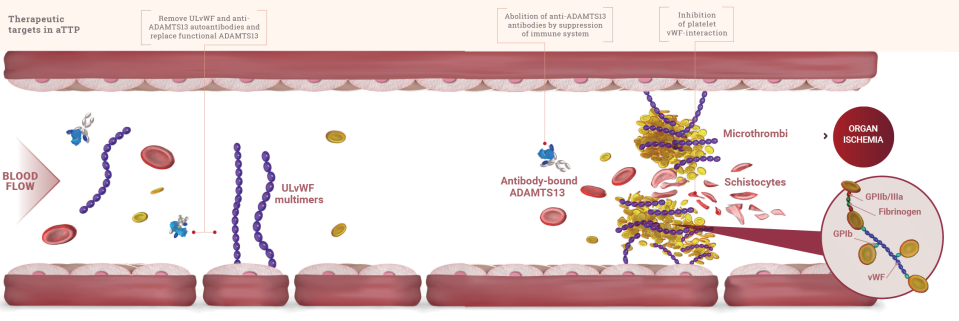 Thrombotic thrombocytopenia purpura physiology
